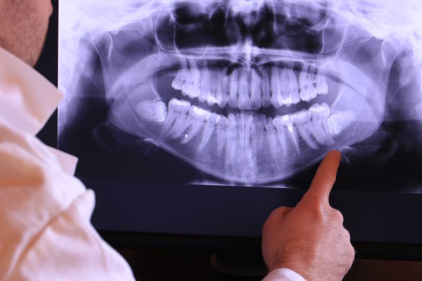 Best Urgent Dental Care for Toothache in Newnan, GA