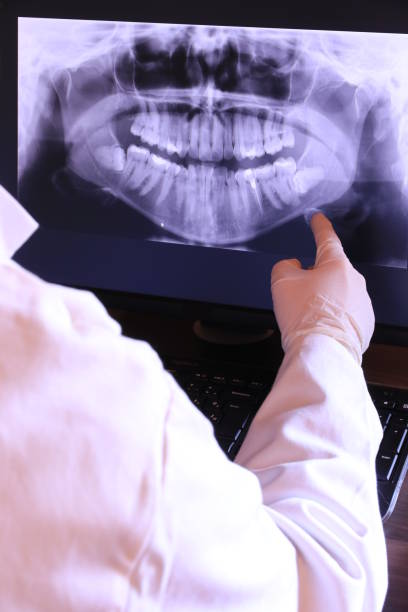 Best Emergency Dental Care for Abscessed Tooth in Newnan, GA