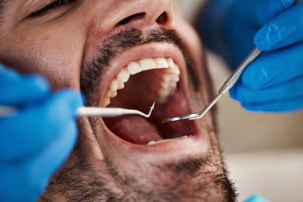 Best Pediatric Emergency Dentist in Newnan, GA